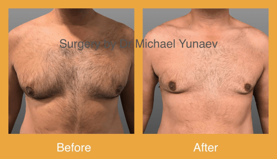 Cosmetic & Reconstructive Breast & Body Surgery Procedures in Coffs Harbour & Sawtell