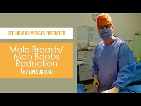 Male Breasts/ Man Boob Reduction