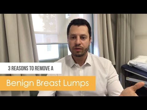 3 reasons to remove a benign lumps